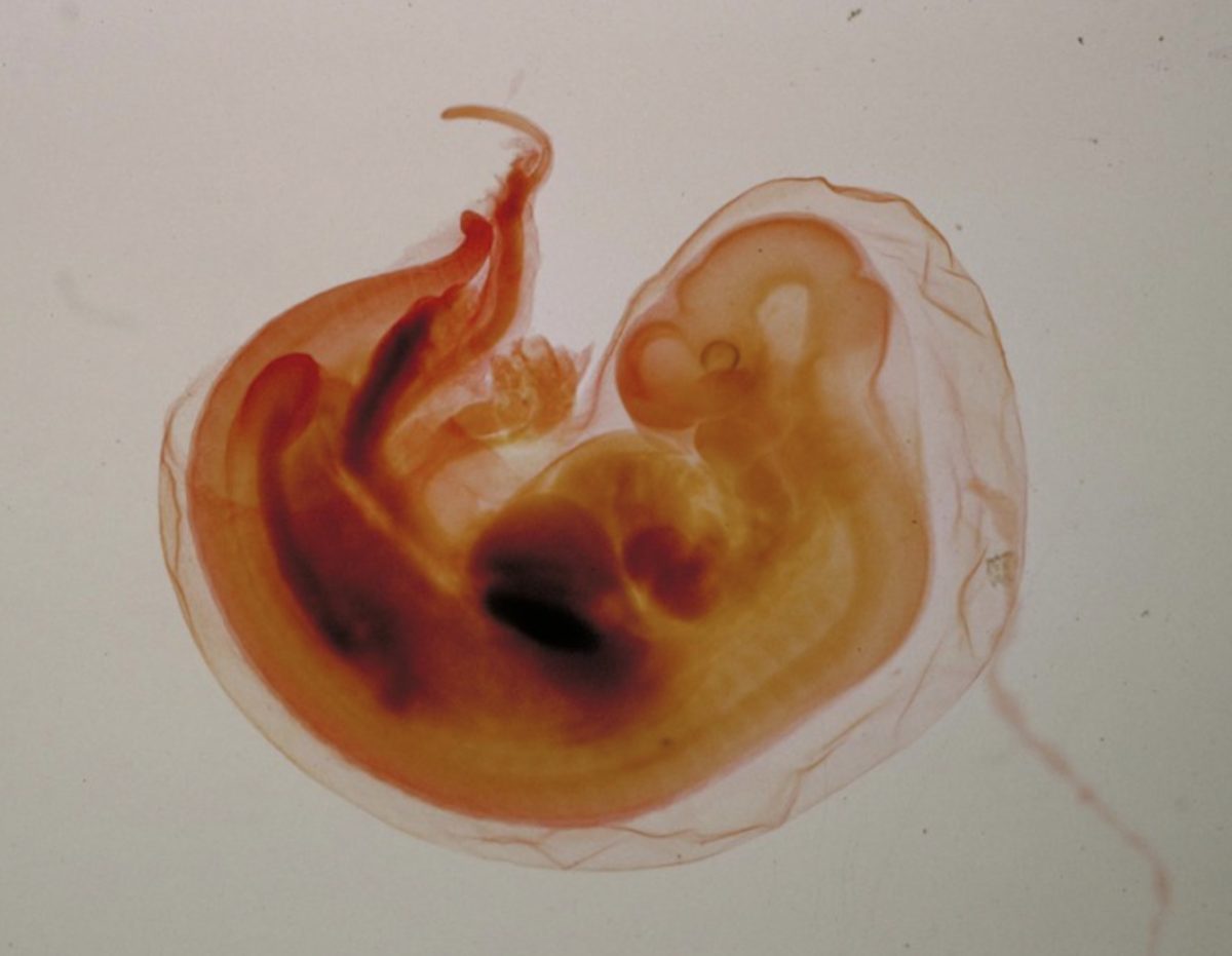 A wild pig embryo as it reaches its 10 millimeters stage.